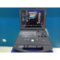 DW-C60 ultrasound echo laptop 3D machine